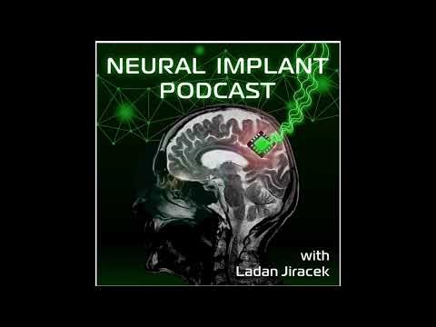 Francesco Petrini - SensArs and the Future of Sensory Neuroprosthetics for Diabetic Neuropathy