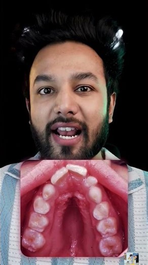 What Rare Body Features You Have #facts #eyes #science