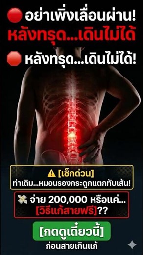 3 อาการเตือน ออฟฟิศซินโดรมขั้นวิกฤต #ออฟฟิศซินโดรม #ปวดหลัง #วิธีแก้ปวดหลัง #ความรู้ #shorts