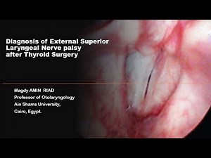 Diagnosis of External Superior Laryngeal Nerve palsy after Thyroid Surgery