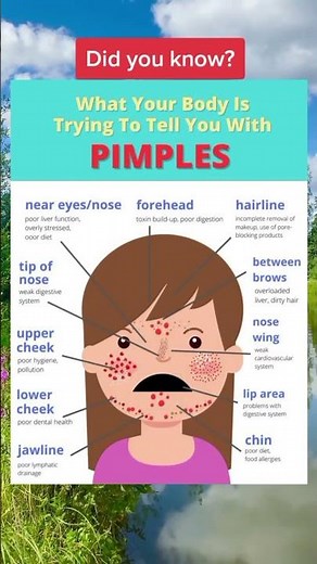 What Your Pimples Are Telling You About Your Health | Acne Face Mapping Explained!