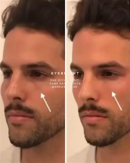 Eyebright™ by Dr. Garo Kassabian