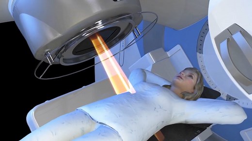 Elekta Oncology – Versa HD