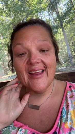 #Glamaw #pawpaw #bariatricsurgery weightloss #fy #fyp Alabama Weight Loss Surgery DrLee Schmitt | Michaeland Jessica Earls