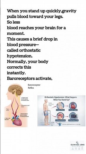 Why do you feel like blacking out when you stand up?#mbbs#biology#neetpg#neetug#medical#anatomy#neet