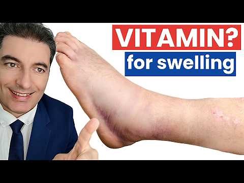 The Best Vitamins & Supplements for Foot Swelling