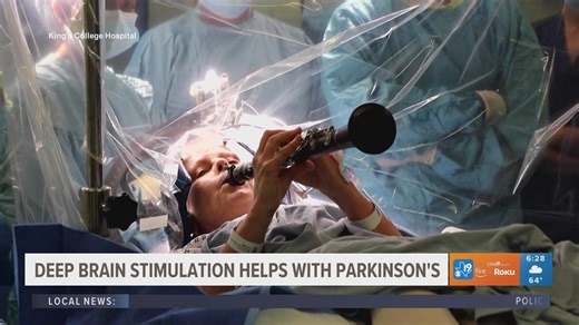 Deep brain stimulation with Parkinson's