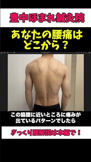 ぎっくり腰で多い筋筋膜性腰痛について解説しました。