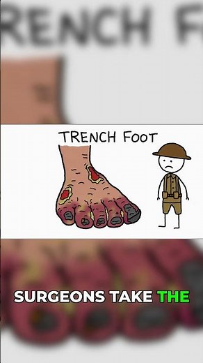 Life Inside a WWI Trench #ww1 #history