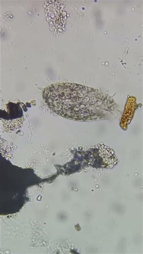 Zooming a drop of water in a microscope||