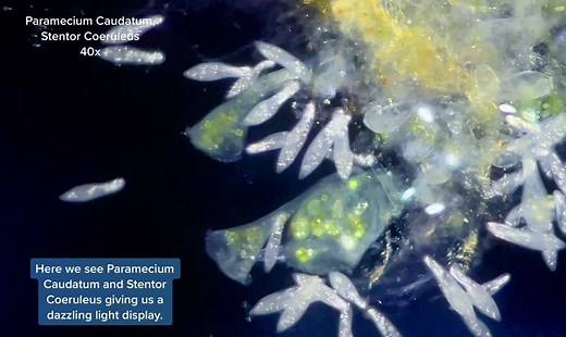 Exploring the Enigmatic Paramecium: A Stunning Microscopic Display