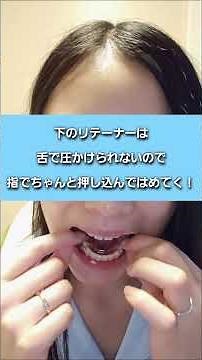 リテーナー(保定装置)の付け方