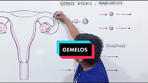 Sistema Reproductor: Gemelos y Embarazo Múltiple