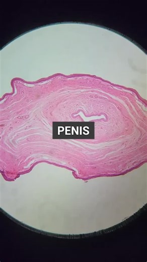 Why do some histology slides instantly make sense while others feel confusing? Because learning to recognize normal tissue architecture is where confidence really starts. 🔬 In this short reel, we’re looking at penile tissue histology, focusing on key structural features you’ll see under H&E. What to notice in this slide: -Vascular spaces within erectile tissue 🩸 -Smooth muscle organization around sinusoids 🧬 -Connective tissue supporting the overall structure Understanding these basics makes 