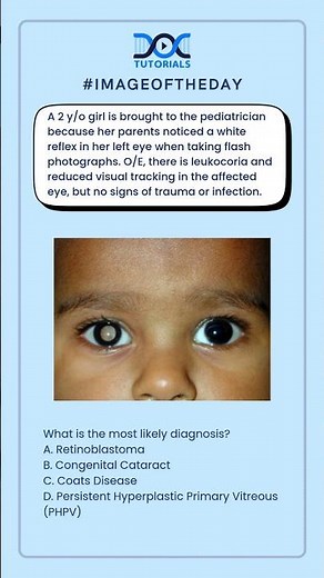 👉 What is the most likely diagnosis?