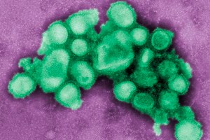 This is how the flu can spread and kill so quickly