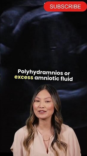 Polyhydramnios: Understanding The Underlying Causes