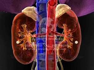 Urosepsis