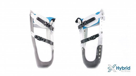 2.2K views · 71 reactions | Introducing the most advanced Socket-less Socket™ yet. The New cX Hybrid is the simplest and most effective Socket-less Socket™ to fit, and offers unprecedented comfort for amputees in local clinical settings as well as those in developing nations. Check out the training: www.vimeo.com/martinbionics/hybrid | Martin Bionics | Facebook