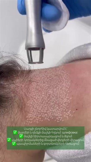 Prolase💚 (@prolase_yerevan)’s videos with Just Fine - Chris Alan Lee