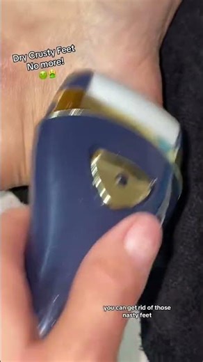 Get rid of your dirty crusty feet before spring! #pritech #callustreatment #dryfeet #feetcare