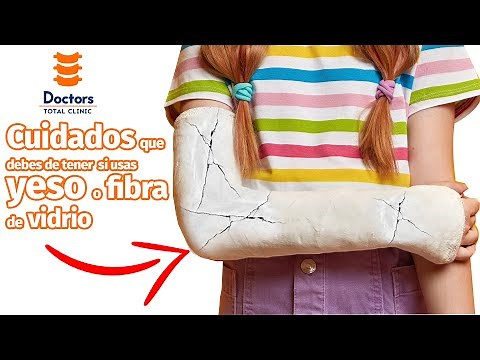 Tips más actualizados si usas yeso o fibra de vidrio / para fracturas y lesiones