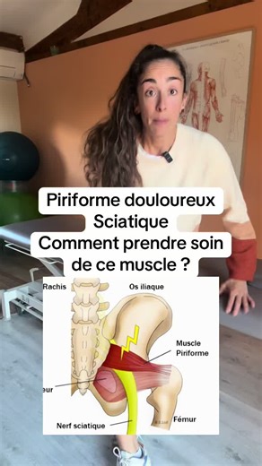 Prendre soin du muscle piriforme pour soulager la sciatique