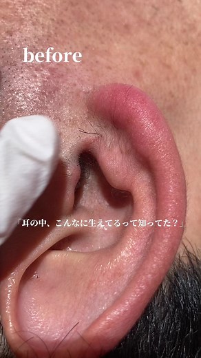 耳毛処理の新常識：ビジネスマン必見