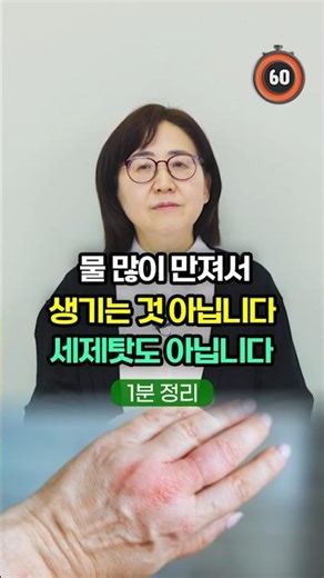 연고 발라도 주부습진이 계속 재발하는 이유? 물 때문이 아닙니다! [1분 정리]