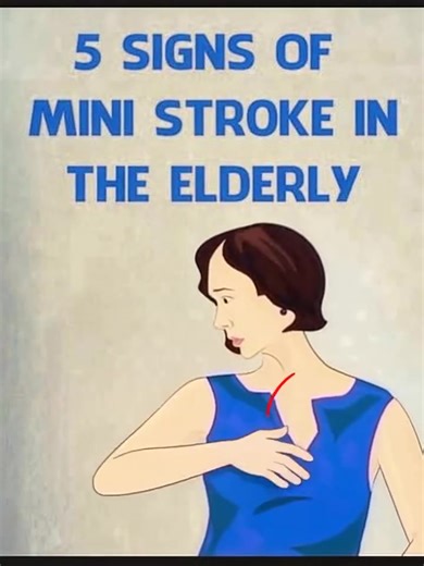 5.4K views | 5 signs of mini str0ke in the elderly Check 1st comment  | Light Aura | Facebook