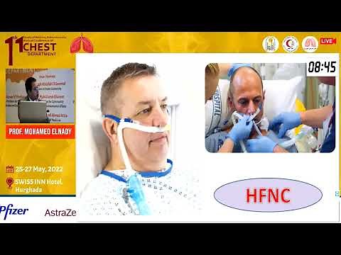 Oxygen in the critically ill: friend or foe?