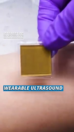249K views · 2.3K reactions | MIT engineers designed these ultrasound stickers to provide live images of a patient's internal organs. It can be easily applied and provide continuous ultrasound for 48 hours. In the near future, patients may buy them from pharmacies like band-aids instead of going to hospitals or doctor's offices. | Interesting Engineering | Facebook