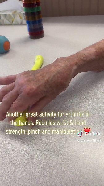 Hand Therapy Activities for Arthritis Relief