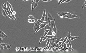 癌细胞在显微镜下是什么样的？