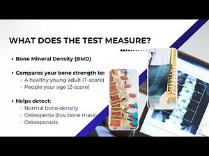 Bone Density Testing