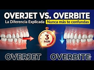 Overjet vs Overbite: The Difference Explained in 3 Minutes (Never Get Confused Again)