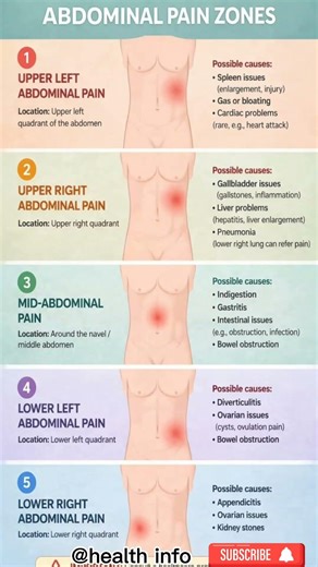 5 Common Abdominal Pain Zones and Their Causes #healthtips #medical #pain