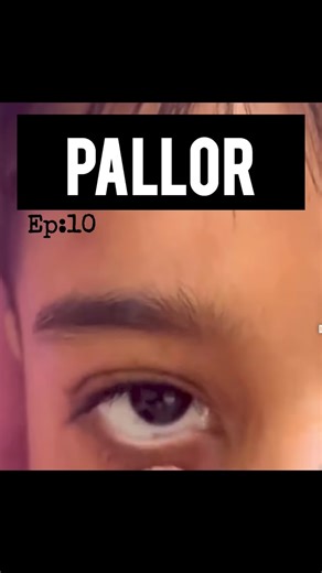 Sudharshini K | Pallor. . . . Follow @shinikaa_ for more medschool content A! VC: YT/cerebellumacademy. • #life #medstudent #clinicalsmadeeasy... | Instagram