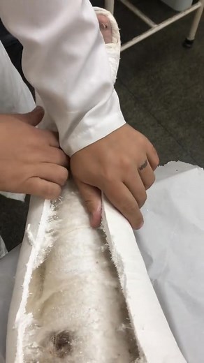 23K views · 128 reactions | ASMR Plaster & unboxing. #plaster #asmr #foryoupage #fyyyyyyyyyyyyyyyy #fyppp #asmrtiktoks #fyp #fouryou #umboxing #fy #asmrvideo #explore #explorer #explorar #featureme #gesso #cast #caster #elenco #slc #llc #lac | Fluentjoy Learn English | Facebook