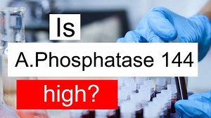 Is Alkaline phosphatase 144 high, normal or dangerous? What does ALP level 144 mean?