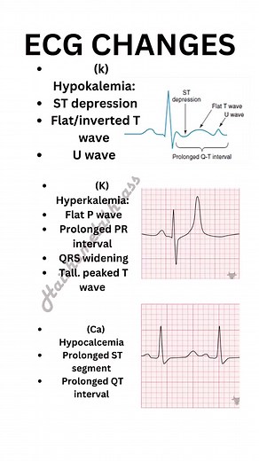 #echocardiogram #ECG #pacemeker #cardiacarrest #cardiacnurse #cardiacsurgery #cardiac_world