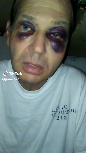 Panda Eyes 🐼#pandaeyes🐼 #abuseawareness #blacktiktokcommunity🥰 #fyp #jail #tiktok