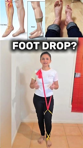 Foot Drop? Quick Support Hack #footdrop #quicktips #hacks #fix