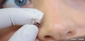 नाक-कान छिदवाने के बाद इंफेक्शन से बचाव में काम आएंगे ये 9 घरेलू उपाय