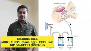 26 reactions · 17 shares | Intercostal Tube Drainage= ICD INSERTION Medical Information for patient education | Dr Bibin Jose | Facebook