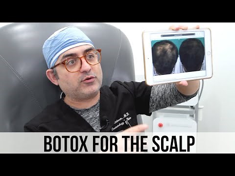 Botox for Hair Growth (Reverse Stress Related Hair Loss)