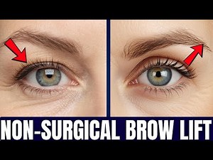 How to Lift Droopy Eyelids Naturally | No Surgery Needed