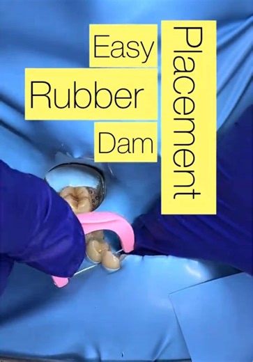 ‏Easy rubber dam placement
