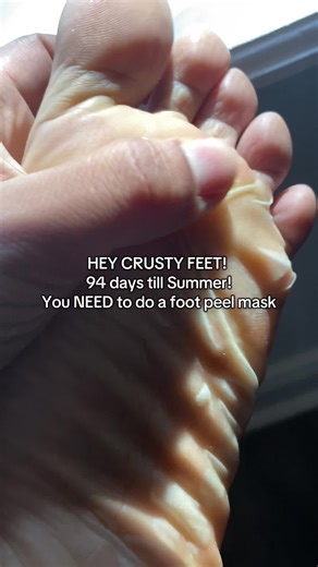 Rejuvenate Your Feet with a Foot Peel Mask