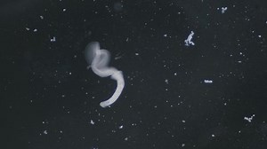 Trematode Parasitic Worm Escaping Leaving Parent Stock Footage Video (100% Royalty-free) 1095849889 | Shutterstock